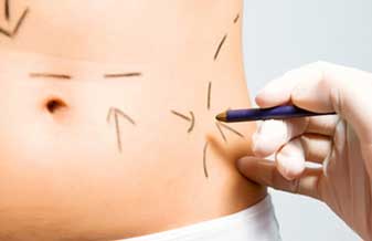 Clínica Tournieux – Cirurgia Plástica - Foto 1